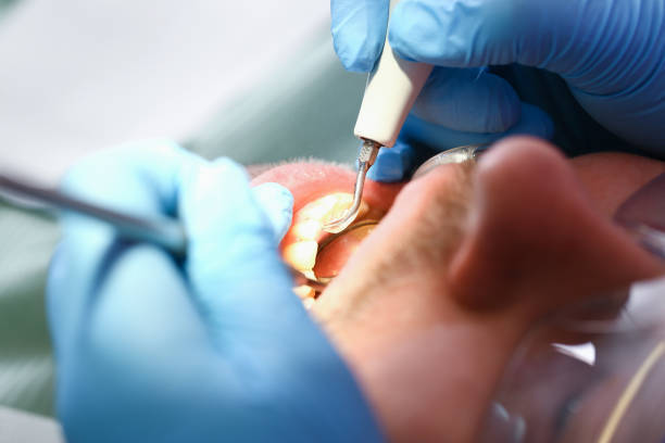 Best Knocked-Out Tooth Emergency  in Wilmington, OH