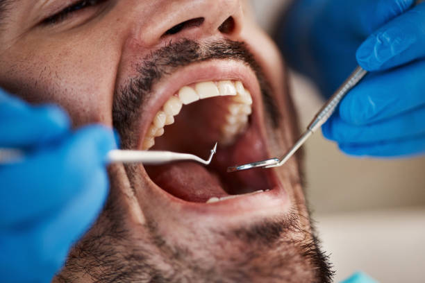 Best Chipped Tooth Repair Near Me  in Wilmington, OH